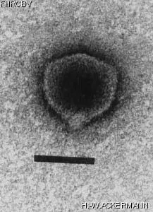 HER1 Image of phage under microscope