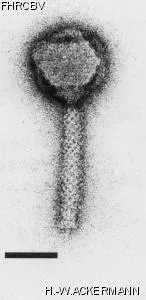 HER100 Image of phage under microscope