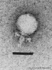 Image of phage under microscope