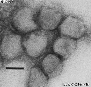 HER102 Image of phage under microscope