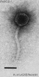 HER103 Image of phage under microscope