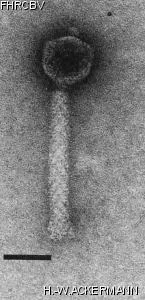 HER104 Image of phage under microscope