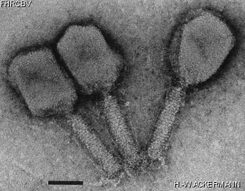 HER105 Image of phage under microscope