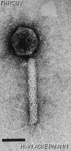 HER106 Image of phage under microscope