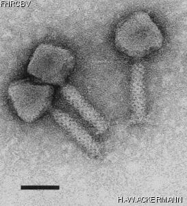 HER109 Image of phage under microscope