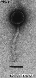 HER11 Image of phage under microscope