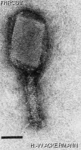 HER110 Image of phage under microscope