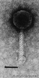 HER111 Image of phage under microscope