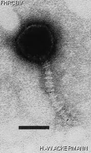 Image of phage under microscope