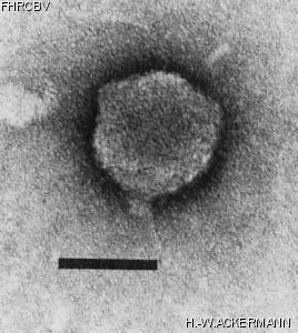 HER117 Image of phage under microscope