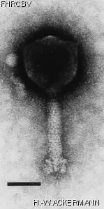 HER118 Image of phage under microscope