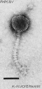 HER119 Image of phage under microscope