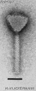 HER12 Image of phage under microscope