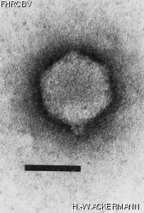 Image of phage under microscope