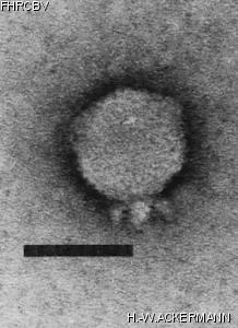 HER122 Image of phage under microscope