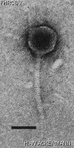 HER124 Image of phage under microscope