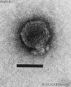 HER125 Image of phage under microscope