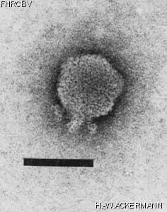 HER126 Image of phage under microscope