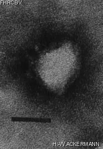 HER127 Image of phage under microscope