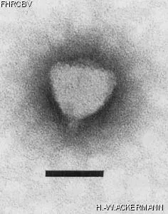 HER132 Image of phage under microscope