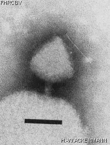 HER133 Image of phage under microscope