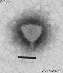 HER134 Image of phage under microscope