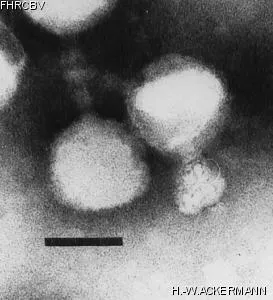 Image of phage under microscope