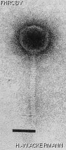 Image of phage under microscope