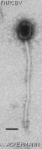 HER137 Image of phage under microscope