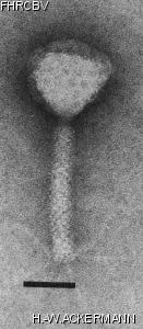 HER14 Image of phage under microscope