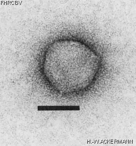 Image of phage under microscope