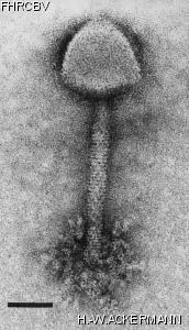 HER141 Image of phage under microscope