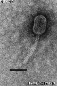 HER142 Image of phage under microscope