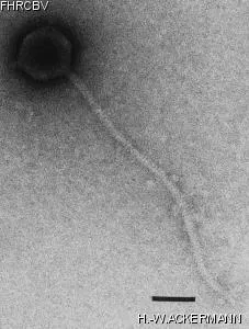 Image of phage under microscope