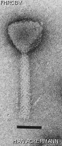 HER146 Image of phage under microscope