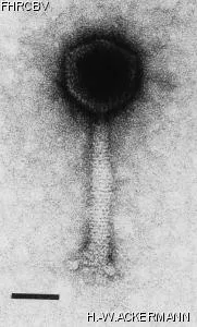 HER148 Image of phage under microscope