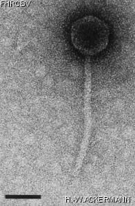 HER149 Image of phage under microscope