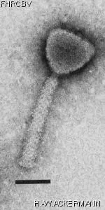 HER15 Image of phage under microscope