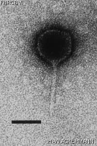 HER151 Image of phage under microscope