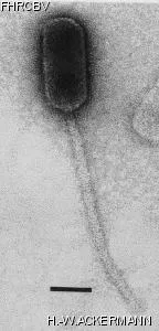 HER152 Image of phage under microscope