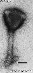 HER153 Image of phage under microscope