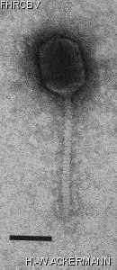 HER154 Image of phage under microscope