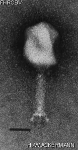 HER155 Image of phage under microscope