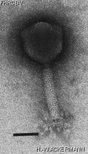HER156 Image of phage under microscope