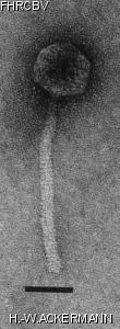HER157 Image of phage under microscope