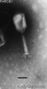 HER158 Image of phage under microscope