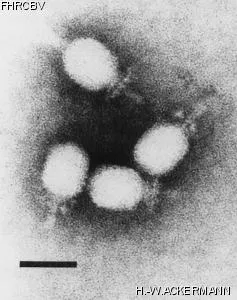 Image of phage under microscope