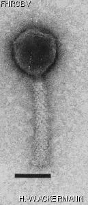 HER16 Image of phage under microscope