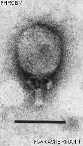 Image of phage under microscope