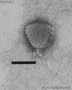 HER161 Image of phage under microscope